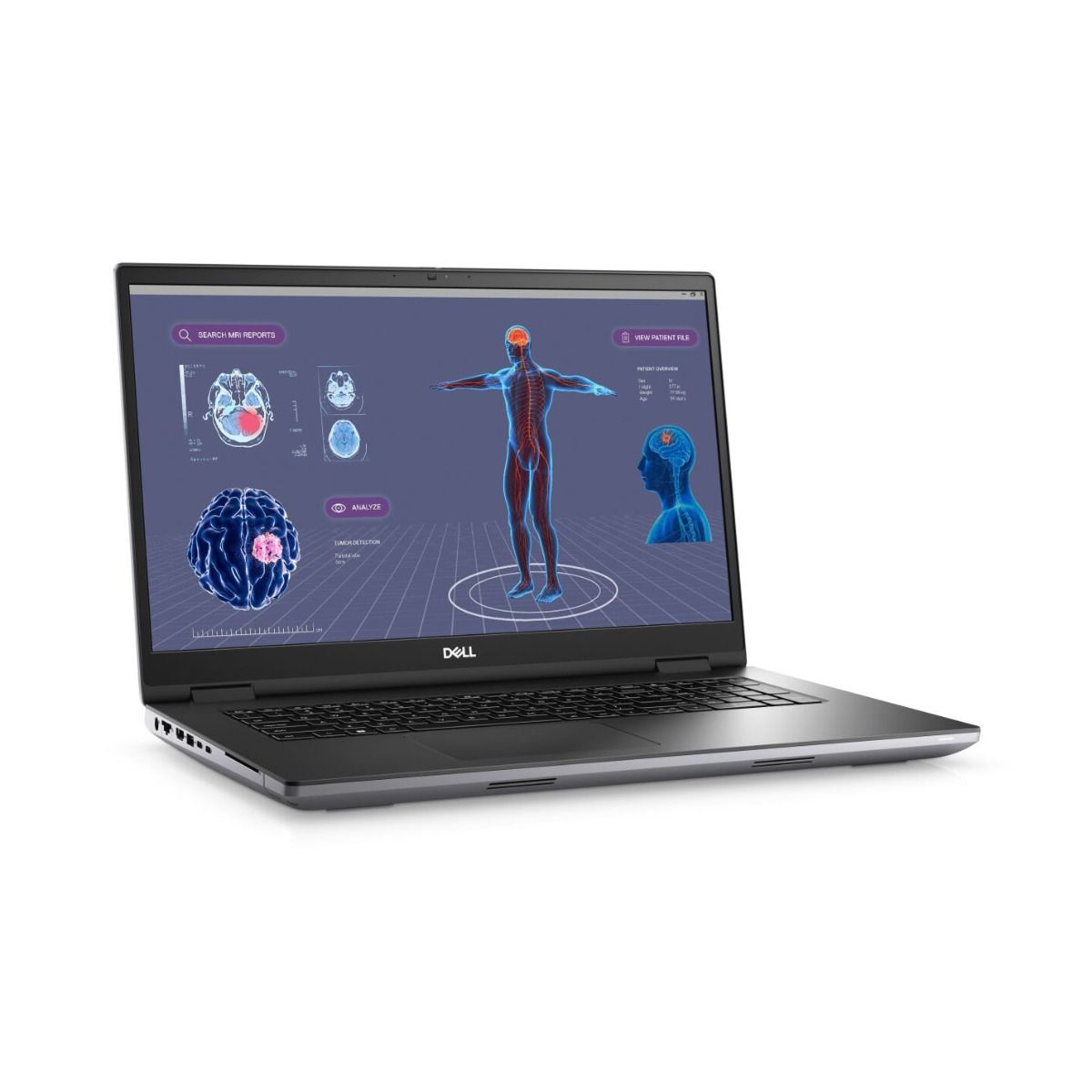 Dell Precision 7780 17.3" Laptop Intel Core i9 32GB RAM 1TB SSD RTX 3500 ADA