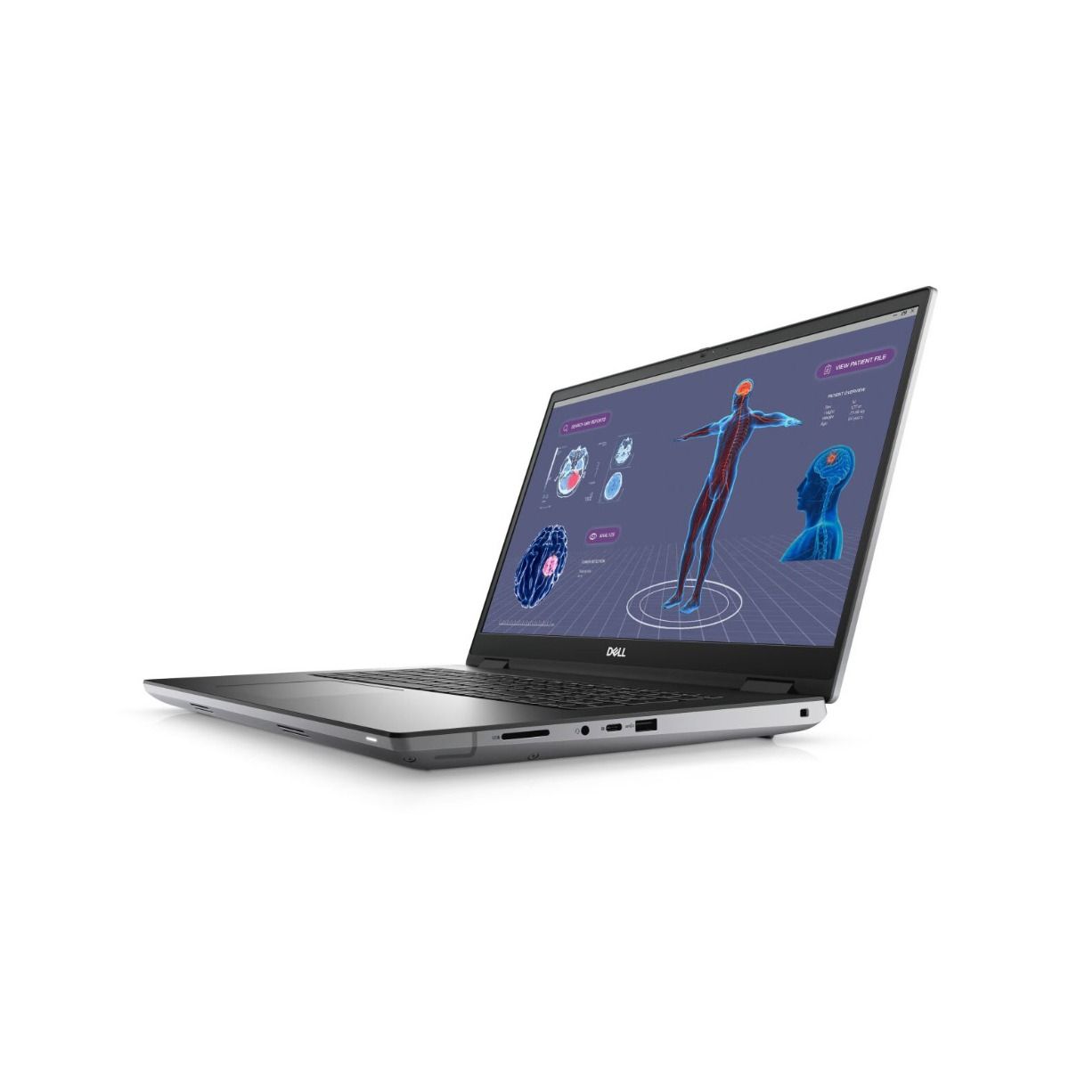 Dell Precision 7780 17.3" Laptop Intel Core i9 32GB RAM 1TB SSD RTX 3500 ADA