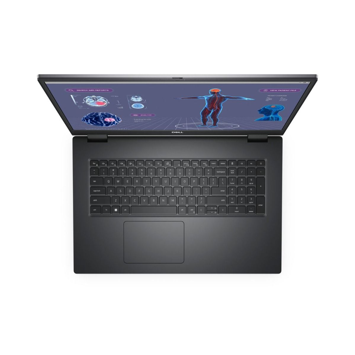 Dell Precision 7780 17.3" Laptop Intel Core i9 32GB RAM 1TB SSD RTX 3500 ADA