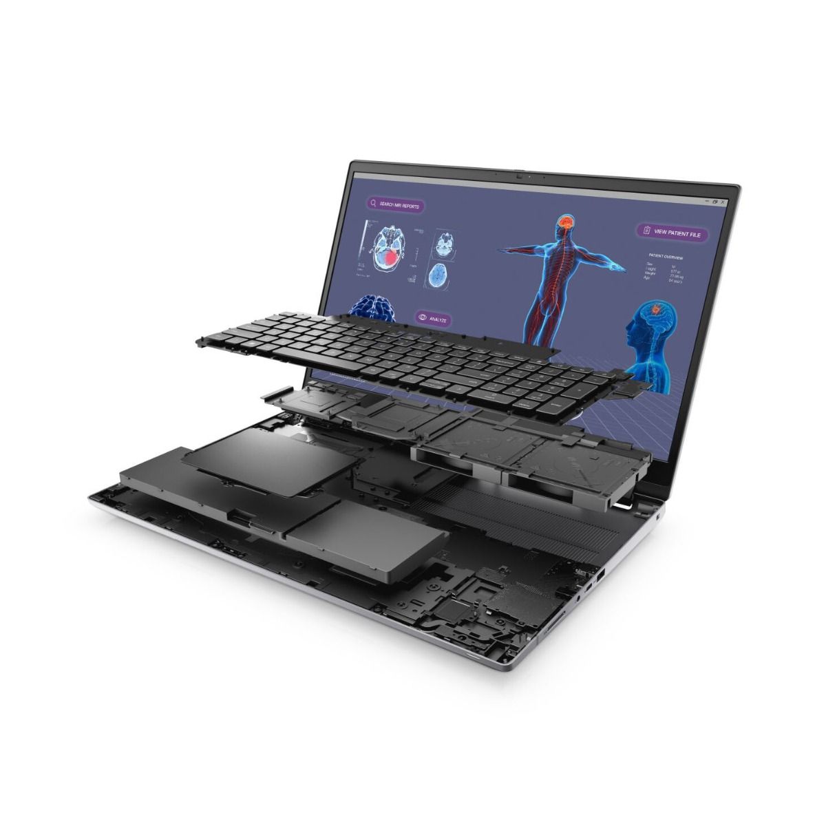 Dell Precision 7780 17.3" Laptop Intel Core i9 32GB RAM 1TB SSD RTX 3500 ADA